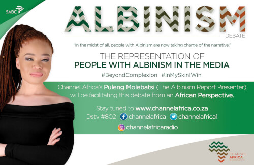 Channel Africa Tackles Albinism