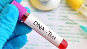 How Much is DNA Test at Clicks in South Africa