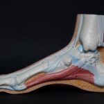 How Much Does RAF Pay for a Broken Leg in South Africa